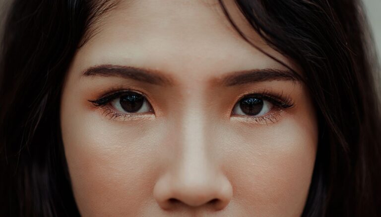HIKO Nose Thread Lift: The Ultimate Guide Before Considering Nose Threads